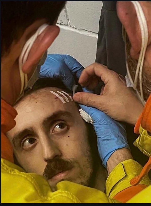 Striking Resemblance to 1600s Portraits Captivates Online Users - His Face Is From 1600s Paintings