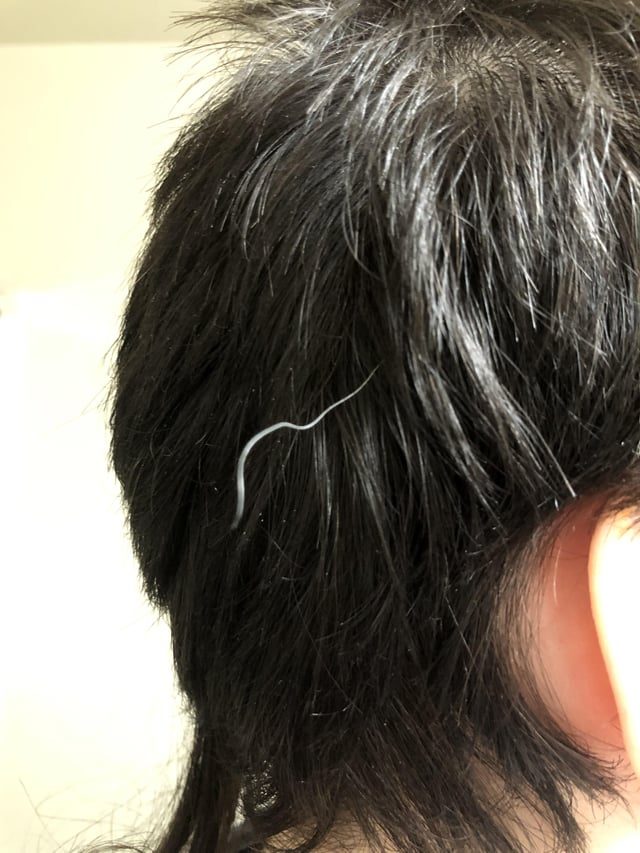 Unique Hair Mystery: A 22-Year-Old's Singular White Strand - I’m 22f, Why Do I Have One White Hair That Is Twice As Long As All My Hair And Is Shiny?