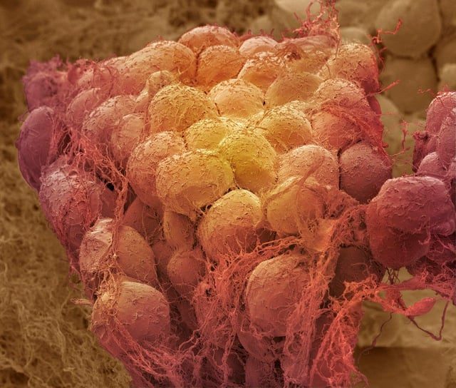 Study Reveals Obesity's Long-Term Impact on Fat and Immune Cells - Obesity Leaves A Lasting Imprint On Fat And Immune Cells In Ways That Might Make Weight Regain Harder To Avoid