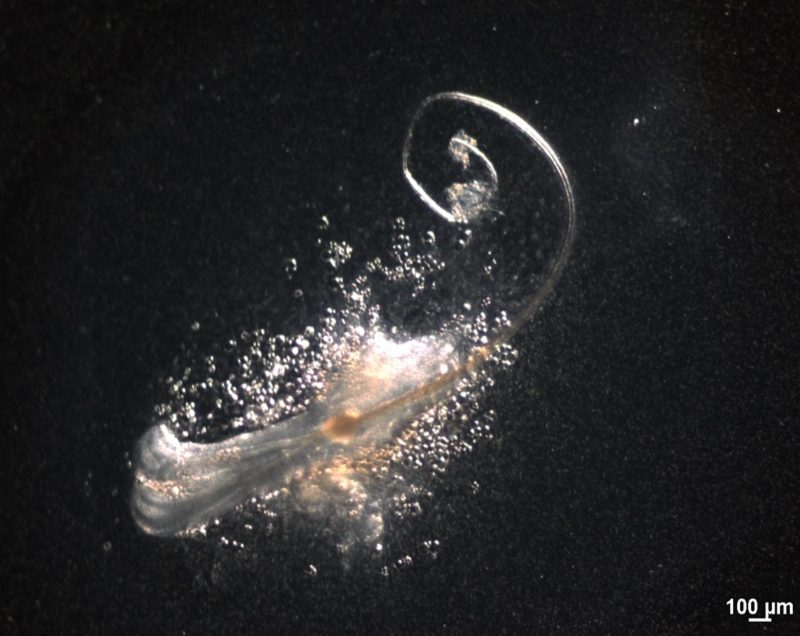 Breakthrough in Hair Regeneration Science by OrganTech - OrganTech Defines Minimal Stem Cell Set Enabling Functional Hair Follicle Regeneration In Vitro