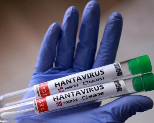 Complete Guide to Hantavirus Is Not Easily Spread, But Is Global Heating Upping Our Exposure?