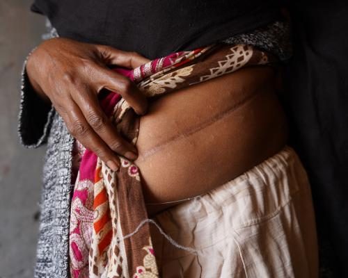 Kidney Trade Exploits Debt-Bound Brick Kiln Workers in Pakistan - ‘The Whole Country Is Doing It’: How Illegal Kidney Traders Target Pakistan’s Desperate Brick Kiln Workers